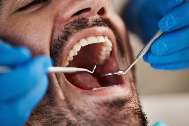 Oral Cancer Screening in West Unity, OH